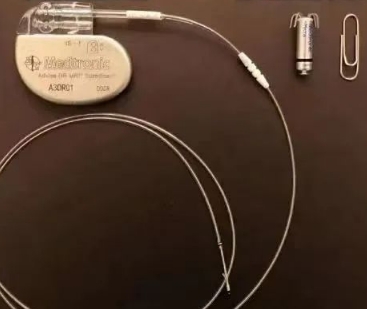 心脏再同步治疗的新时代：双心室起搏器的技术进步与临床效果