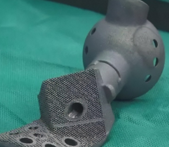 个性化骨科修复的未来：3D打印定制化关节假体的应用与发展