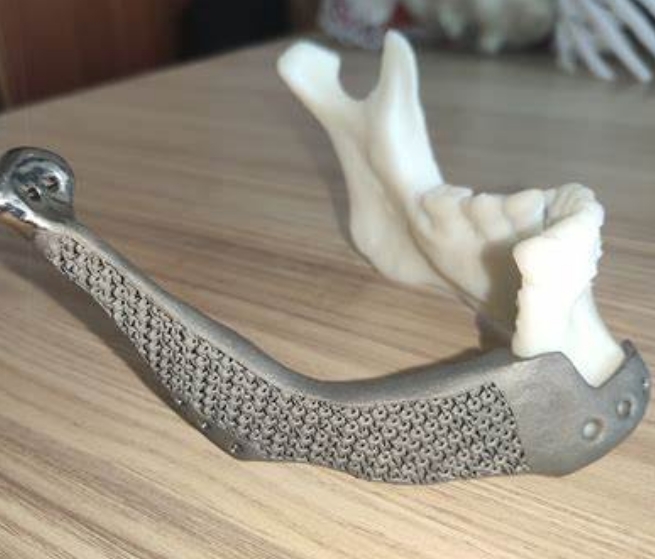 个性化骨科治疗的突破：3D打印骨移植材料的应用与发展