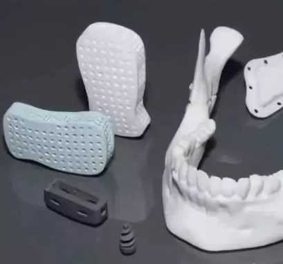 个性化骨科修复的创新：3D打印生物陶瓷植入物的应用与发展