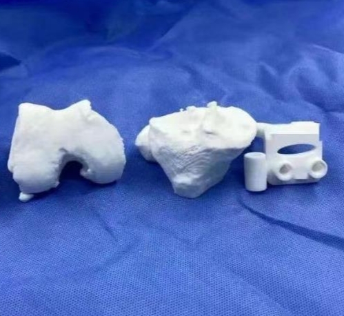 个性化骨科治疗的创新：3D打印定制化骨板的应用与发展