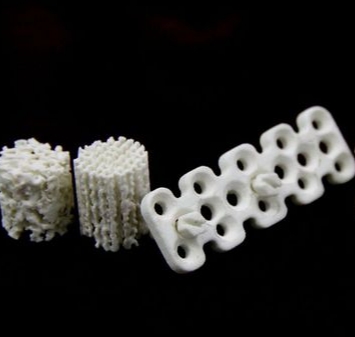 骨骼的建筑师：3D打印生物活性材料定制化修复患者的希望