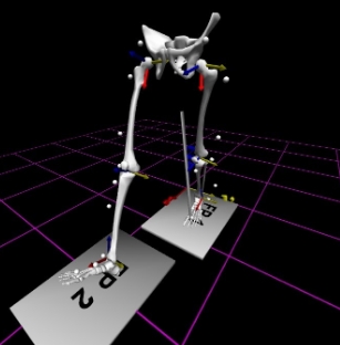智能康复训练的新伙伴：虚拟现实（VR）结合步态分析系统助力患者恢复行走能力