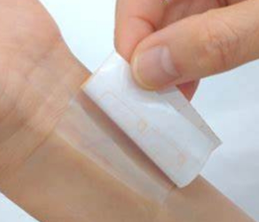 医用粘合剂：无缝连接，安心治疗——医用粘合剂的种类与应用