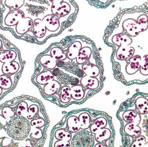 雏菊的伞形花序，明场成像