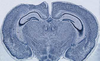 干燥物镜接触到浸镜油