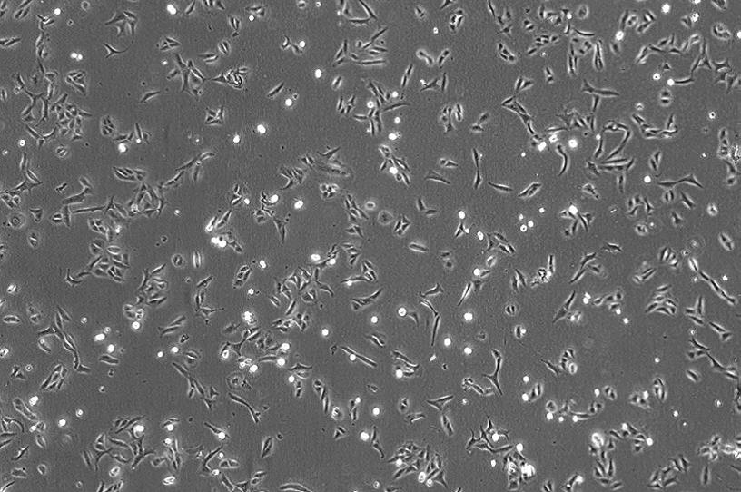 (U2OS 细胞)放大倍率:40×,相差 (U2OS 细胞)放大倍率:40×,相差
