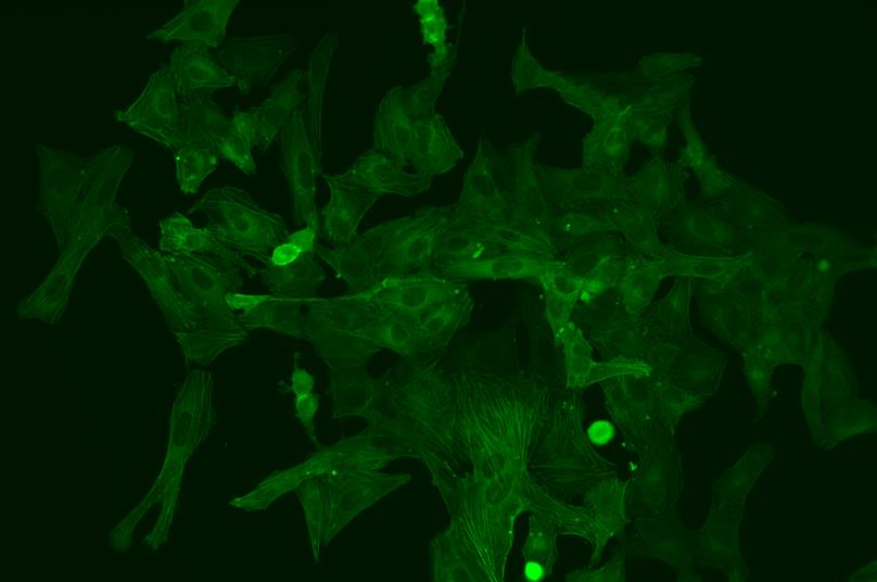 (U2OS细胞,GFP标记)放大倍率:20×,荧光观察 (U2OS细胞,GFP标记)放大倍率:20×,荧光观察