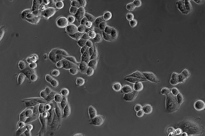 (海拉细胞)放大倍率:20×,相差 (海拉细胞)放大倍率:20×,相差