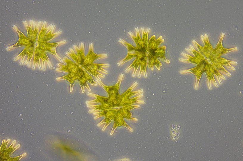 (辐射微星鼓藻)放大倍率:40×,相差 (辐射微星鼓藻)放大倍率:40×,相差