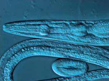 微分干涉(DIC) 棱镜位置下记录的线虫